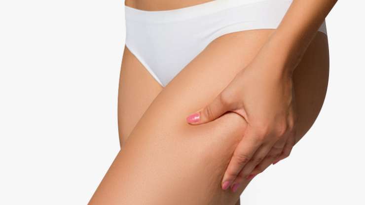 Liposuccion cuisse en Tunisie : la lipoaspiration pour de belles cuisses