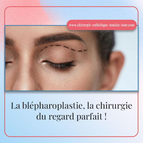 prix blépharoplastie en Tunisie