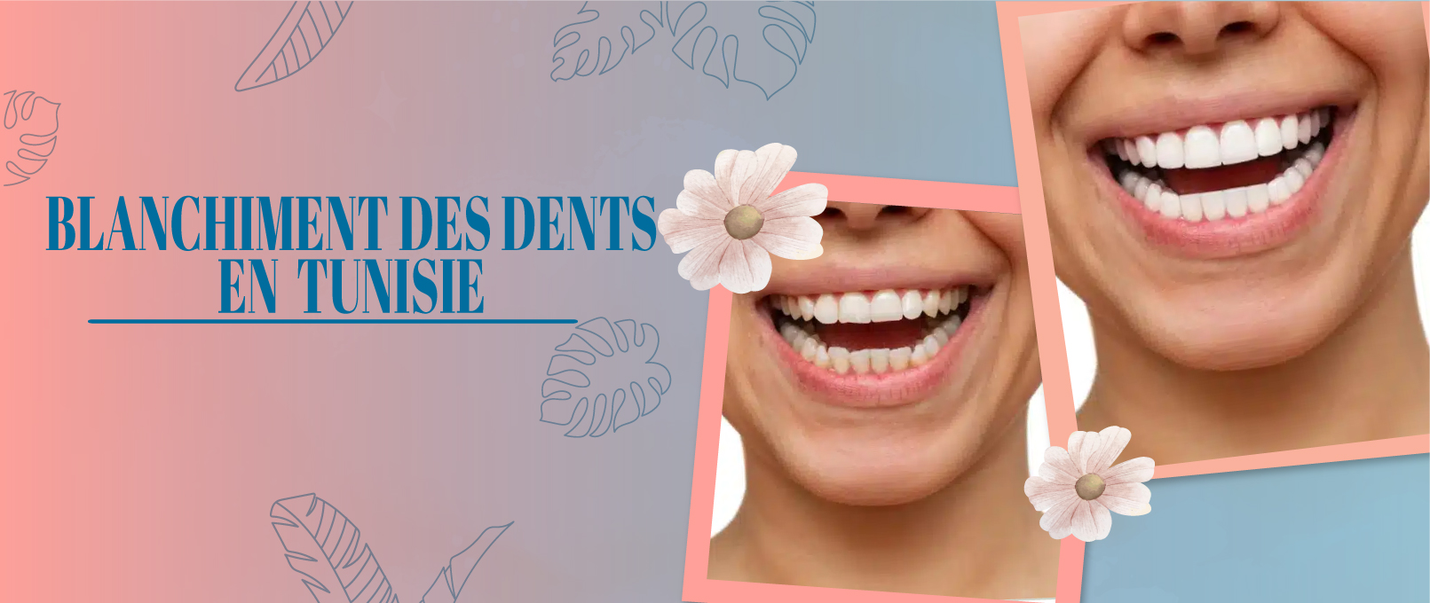 BLANCHIMENT DES DENTS TUNISIE