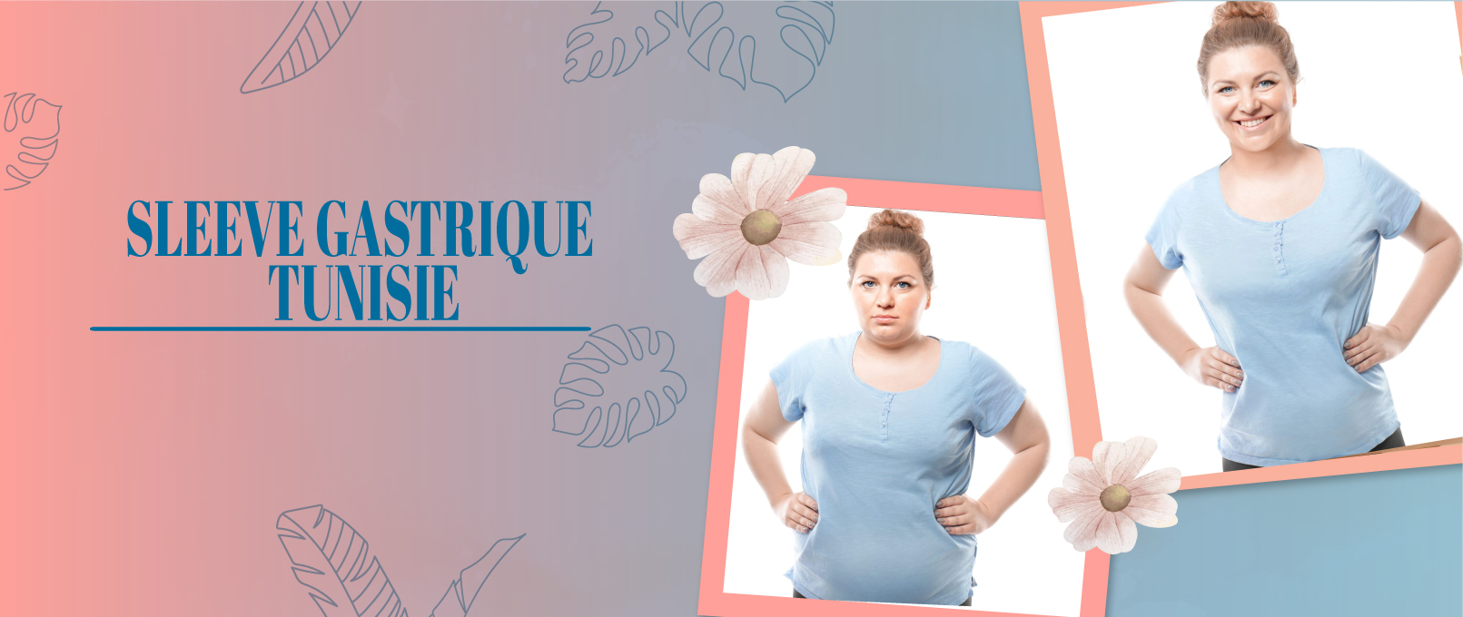 sleeve gastrique tunisie